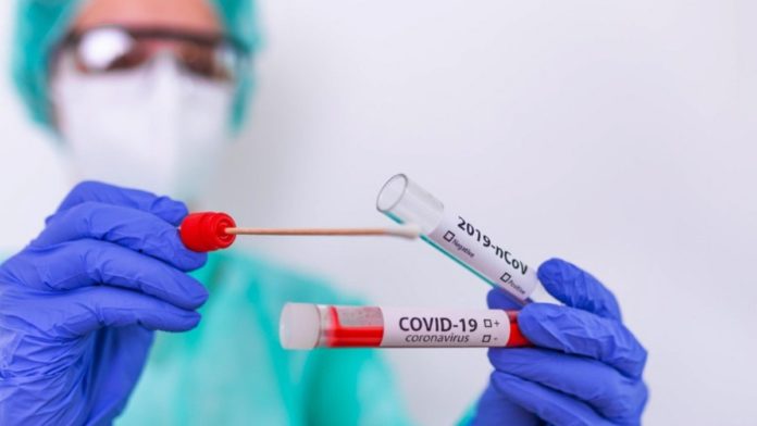Las pruebas diagnósticas TMA, realizadas en el Laboratorio Regional de Salud Pública, son un test ultrasensible que detecta en pocas horas el virus